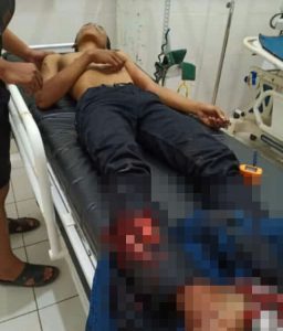 Tabrak Pikap, Pengendara Motor Patah Kaki